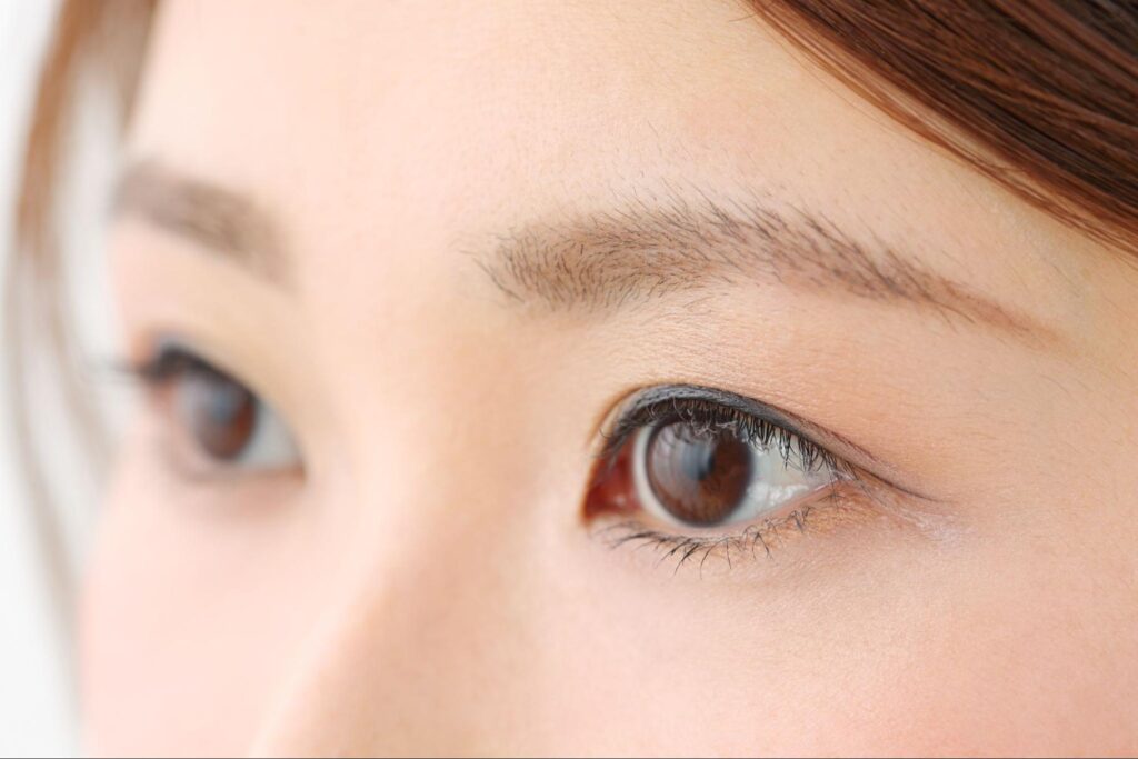 眉下切開(眉下リフト)