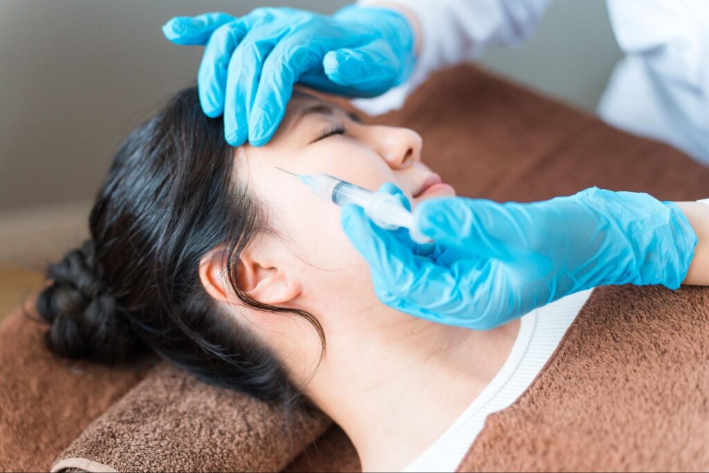 額・こめかみ・頬への脂肪注入