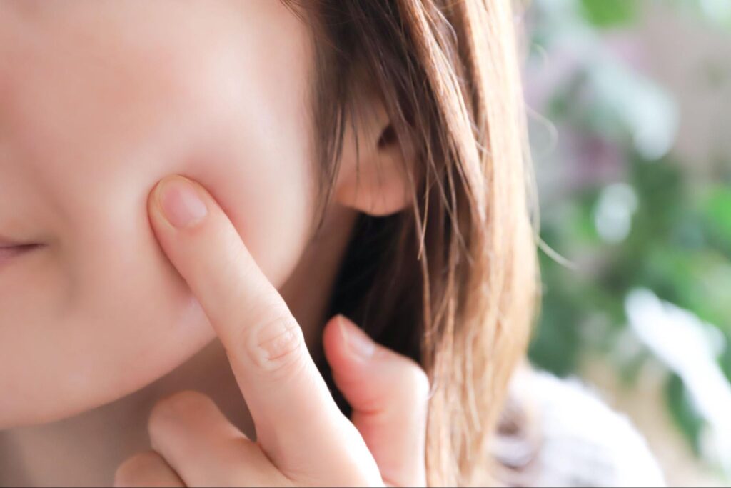 ピコフラクショナル(毛穴・ニキビ跡・肌質改善)