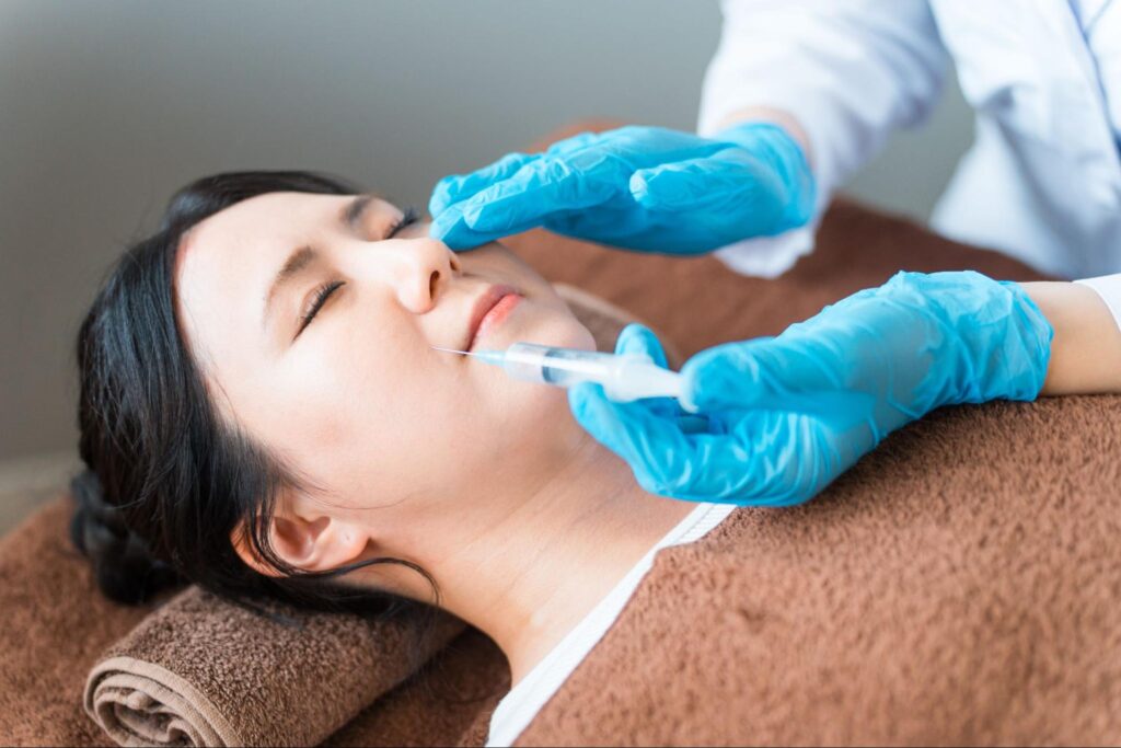 ほうれい線・ゴルゴライン・マリオネットラインへの脂肪注入