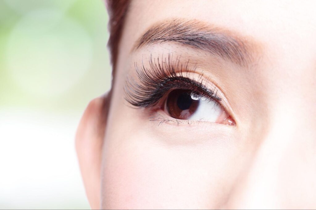 経結膜脱脂術+脂肪注入