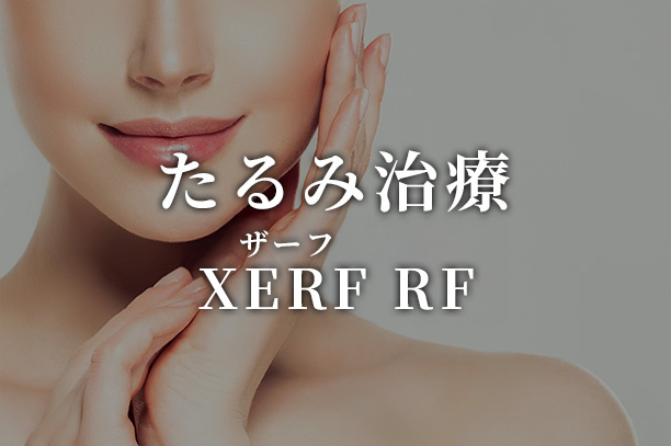 XERF RF（ザーフ)