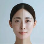 シミ できやすい人